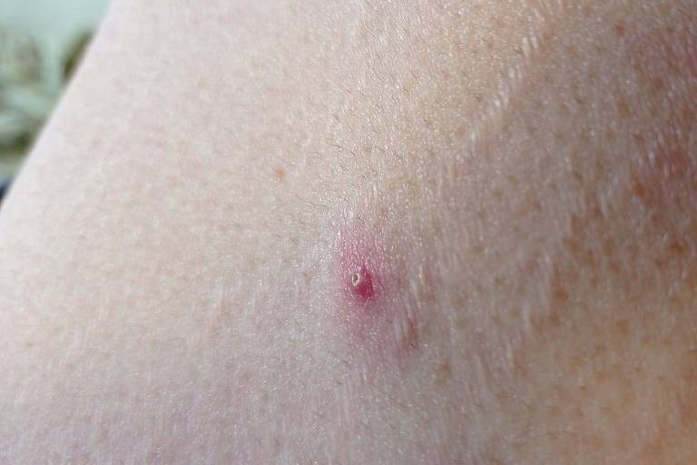 Skin with small red marks