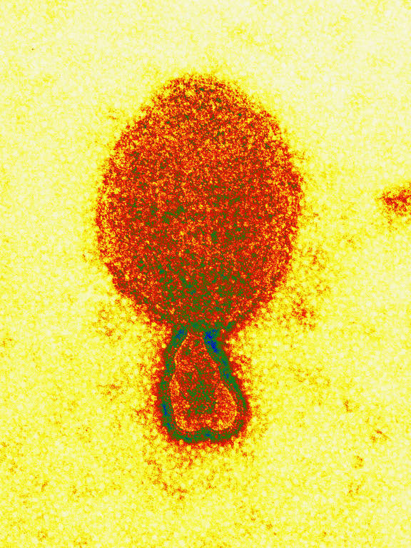 Imagem em microscópio de vírus
