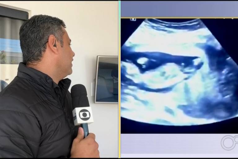 Montagem de homem vestindo camisa cinza escuro segurando microfone e ao lado um ultrassom de bebê