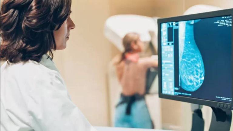 O exame de mamografia deve ser realizado anualmente a partir dos 40 anos de idade, se não houver histórico familiar