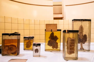 Human pathology specimens made at the Reichsuniversitt Strassburg from 1941 to 1944, on display in a former operating theater at the anatomy building of the University of Strasbourg, in France, May 12, 2022. (Dmitry Kostyukov/The New York Times)
