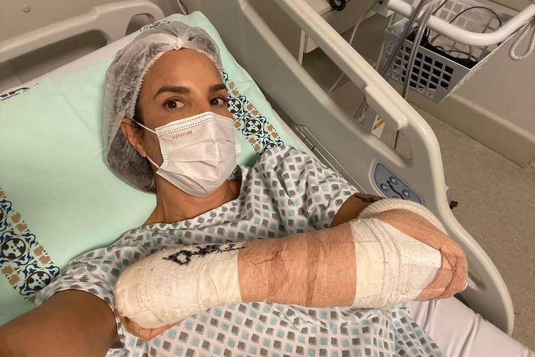 Mulher branca deitada em cama de hospital, com roupas cirúrgicas e gesso no braço