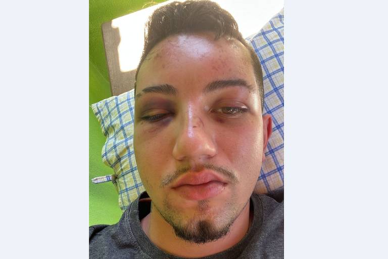 O fazendeiro Marcos Mendonça, 23, relata ter sido agredido por policiais militares em Paineiras (MG)