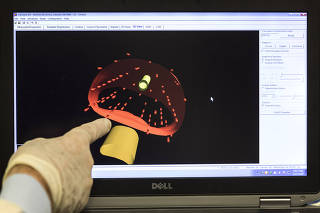 ***Especial Cancer***  Dr Joao Luis Fernandes da Silva (diretor e coordenador do setor de Radioterapia do Hospital Sirio Libanes) observa imagem em 3D  de prostata  em tratamento com  braquiterapia com sementes de iodo