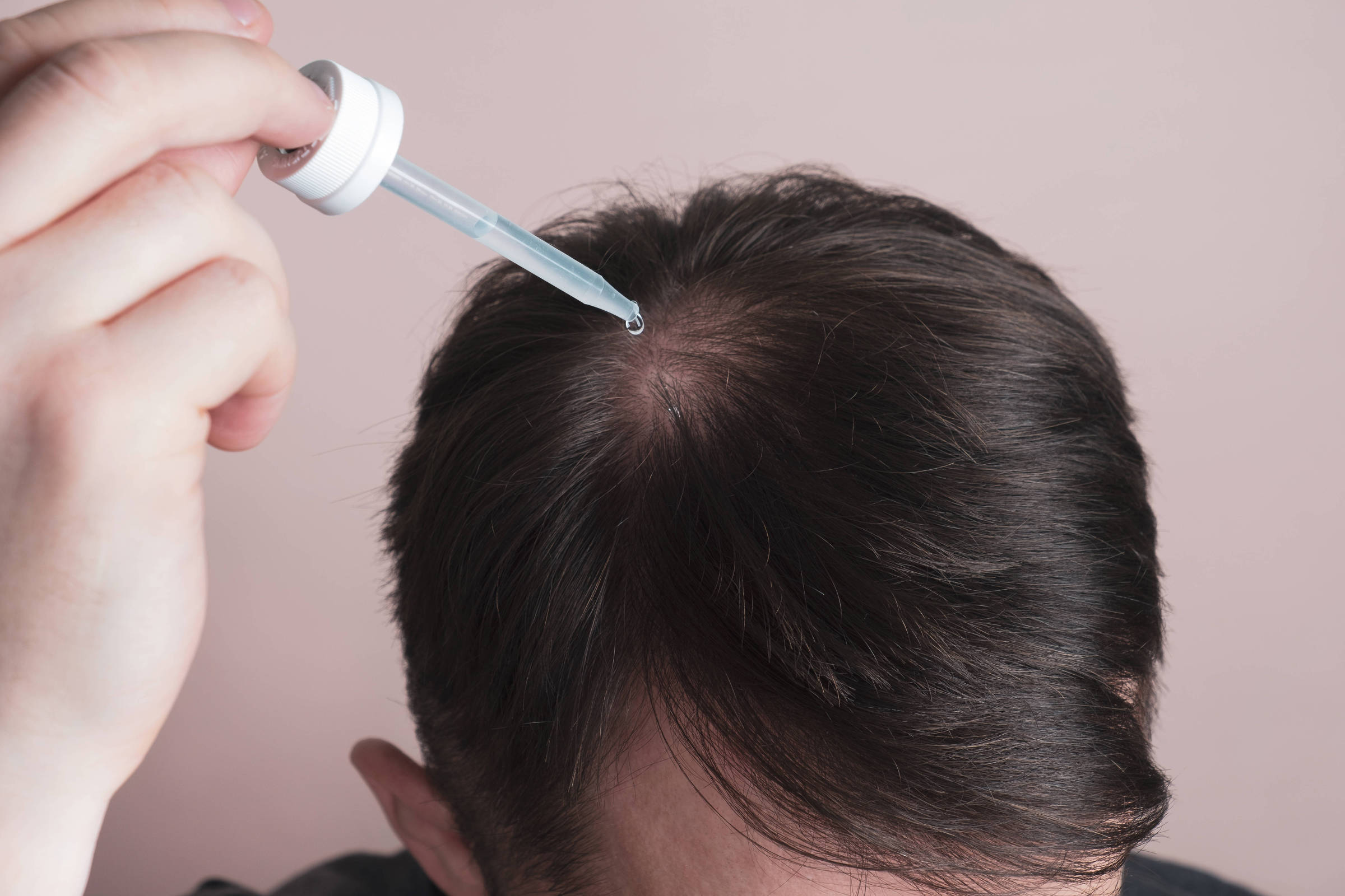 Caindo muito? Veja 5 causas comuns para a queda de cabelo