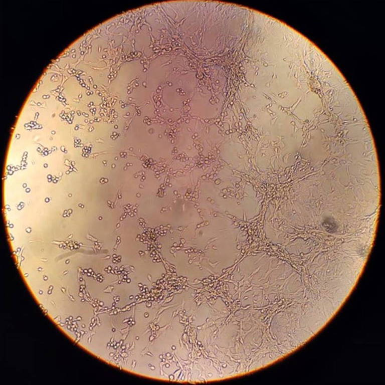 Imagem captada em microscópio invertido evidencia processo de degeneração da célula após infecção pelo vírus da varíola dos macacos
