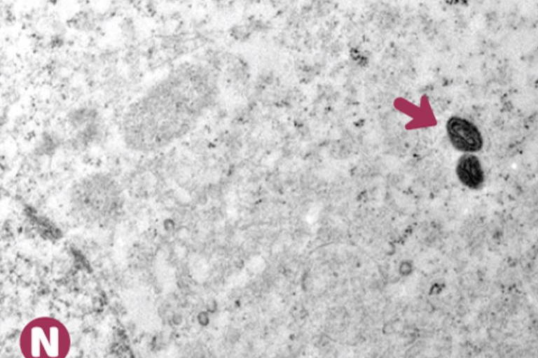 Imagens amplificadas do vírus da mpox