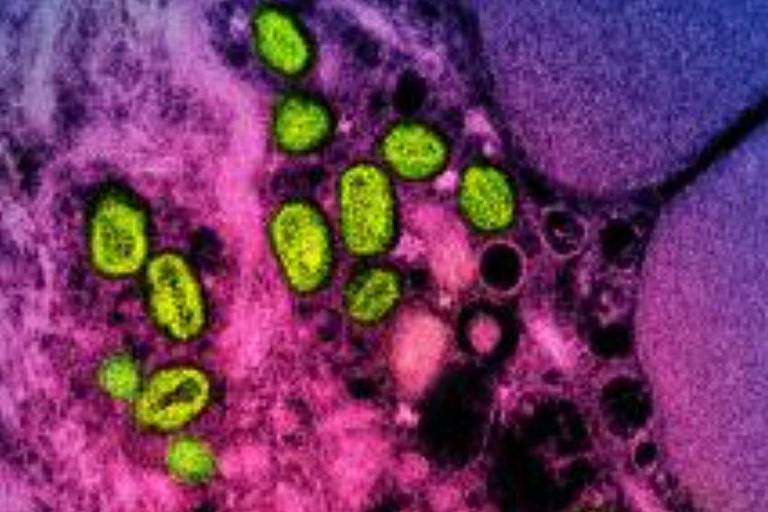 Imagem de microscópio eletrônico mostra vírus da varíola dos macacos (em verde) presentes em uma célula 