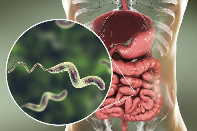 As bactérias podem ser uma das causas para a diarreia aguda