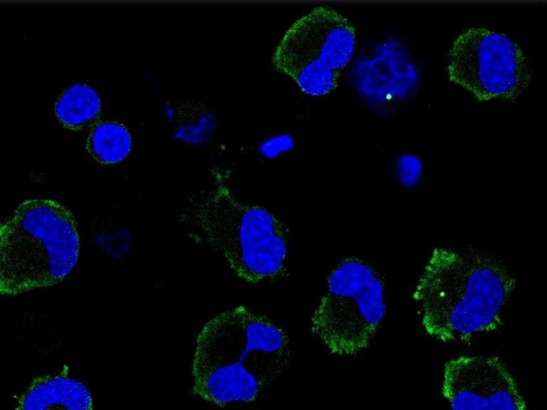 Imunofluorescência de inflamassomas ativos em macrófagos infectados pelo Sars-CoV-2. A proteína ASC, que faz parte dos inflamassomas, está corada em verde. Os núcleos dos macrófagos estão corados em azul