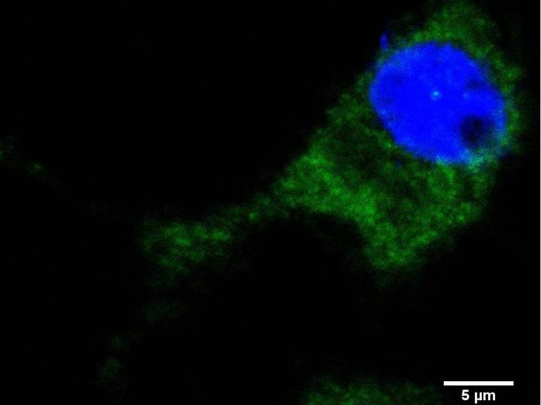 Em verde, via mTOR ativada em macrófago (núcleo em azul)
