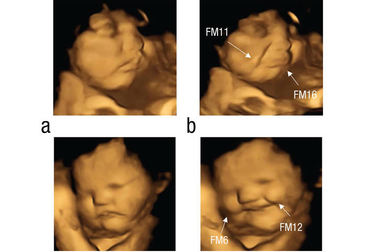 Bebês reagem com expressões faciais a sabores de alimentos no ventre da mãe