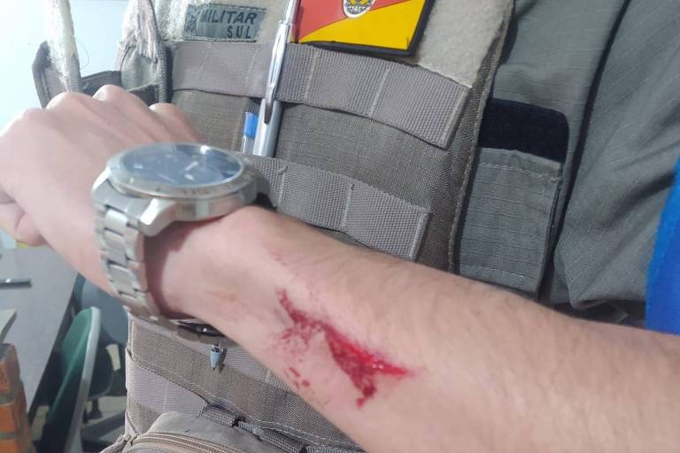 Policial ferido a faca no braço