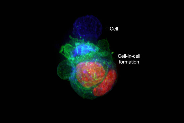 Projeção em 3D de células tumorais, similar a borrões de tinta em várias cores. Os núcleos estão em vermelho e a membrana em volta é verde. Eles estão sendo atacados por uma célula T, pintada de azul.