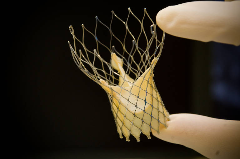 Dois dedos com luvas de silicone seguram uma prótese da válvula aórtica feita de plástico com uma grade ao redor