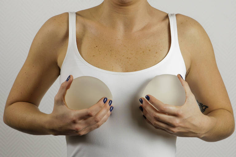 Mulheres com silicone podem fazer mamografia normalmente; a prótese só rompe se estiver velha e desgastada