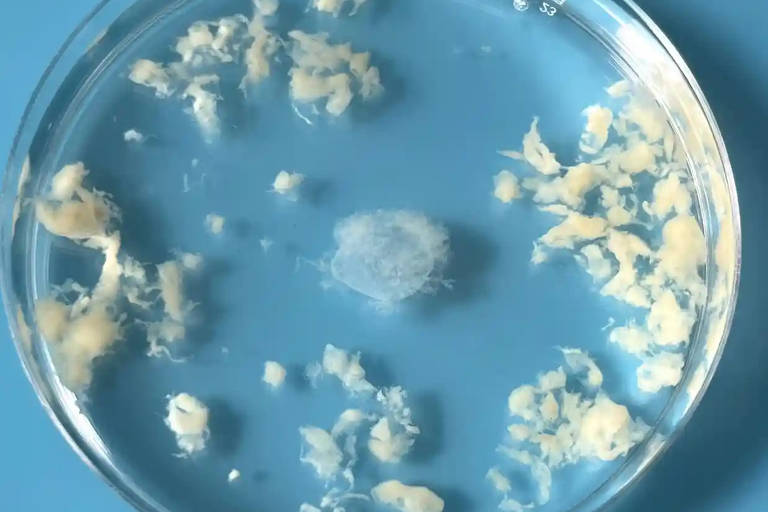 Coleta de decídua (camada funcional do endométrio) e do saco gestacional com nove semanas de gestação