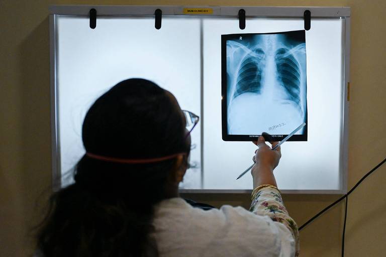 Médica analisa um raio-X de pulmão de um paciente em clínica da organização Médicos Sem Fronteiras, em Mumbai, 
 na Índia