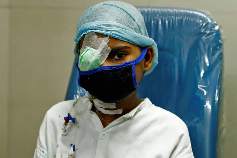 Menina indiana com o olho direito coberto após perdê-lo por causa do mucormicose, conhecido como fungo negro