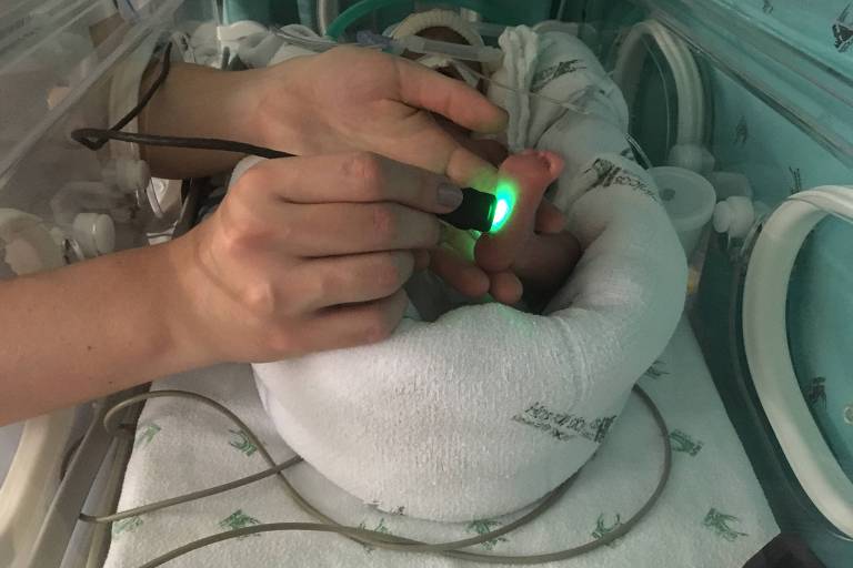 Mãos femininas seguram aparelho que dispara uma luz verde na sola do pé de um bebê prematuro em hospital