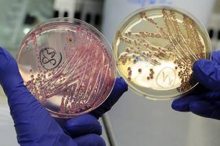 An employee holds petri dishes with bacterial strains of EHEC bacteria in the microbiological laboratory of the 'Universitaetsklinikum Hamburg-Eppendorf ' in Hamburg