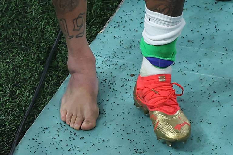 Imagem colorida mostra os dois pés de Neymar, de frente. O direito está descalço, com um inchaço no tornozelo. O esquerdo está com uma chuteira dourada com detalhe vermelho.