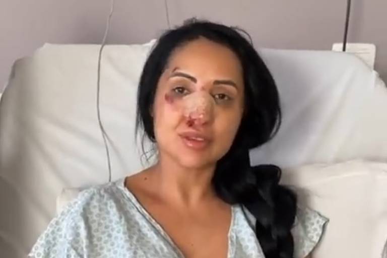 A Fazenda 14: Irmã de Deolane Bezerra briga em bar de São Paulo e tem nariz quebrado
