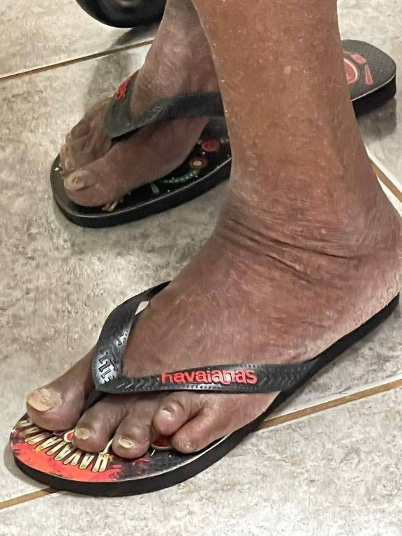 detalhe de pés de idosa de 82 anos