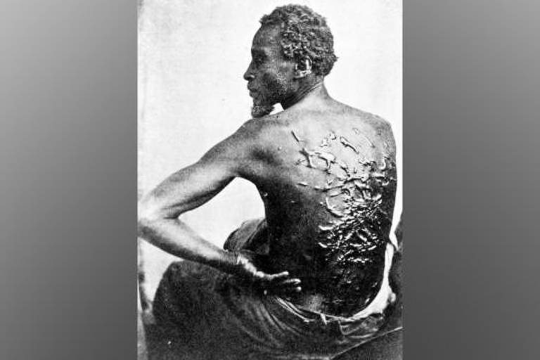 A verdadeira história de 'Peter Chicoteado', cuja foto mudou percepção sobre escravidão nos EUA