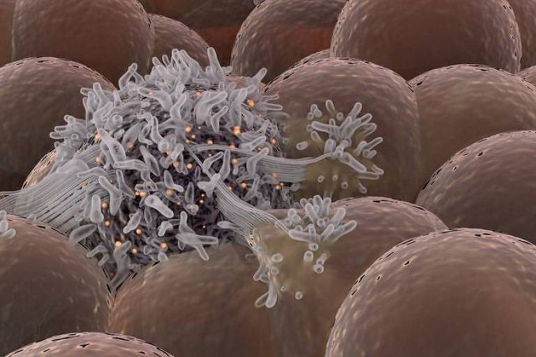 O câncer surge de mutações genéticas que transformam células em células tumorais