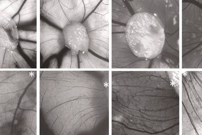 Imagens de astrócitos derivados de células de pacientes com esquizofrenia 