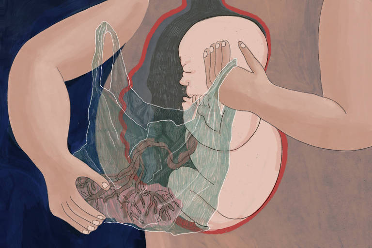 Arte ilustra um bebê dentro da barriga; as mãos da mãe seguram o bebê e um saco plástico; dentro dele está a placenta