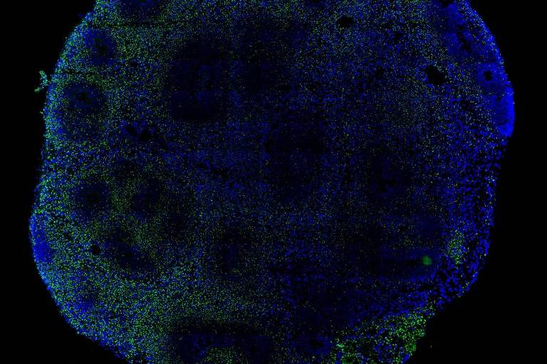 A imagem é de um cérebro sobre um fundo preto. O cérebro é representado por pontos azuis, e alguns pontos verdes se espalham pela superfícia. 