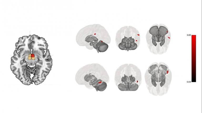 Sete imagens de cérebros feitas por ressonância magnética