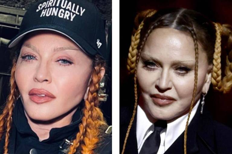 Madonna mostra rosto menos inchado após Grammy