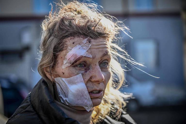 Helena, 53, professora ferida durante um bombardeio russo na Ucrânia; foto se tornou conhecida como uma das mais representativas da guerra