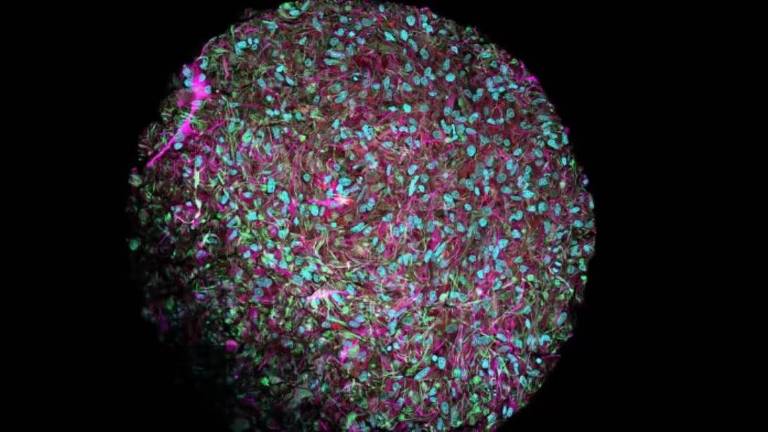 Organoide cerebral visto por um microscópio eletrônico, com os neurônios tingidos de magenta