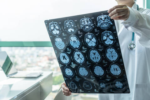 Diagnóstico de doença cerebral com médico vendo filme de ressonância magnética (MRI) diagnosticando problema de doença neurodegenerativa de paciente idoso para tratamento médico neurológico
( Foto: Chinnapong / adobe stock )