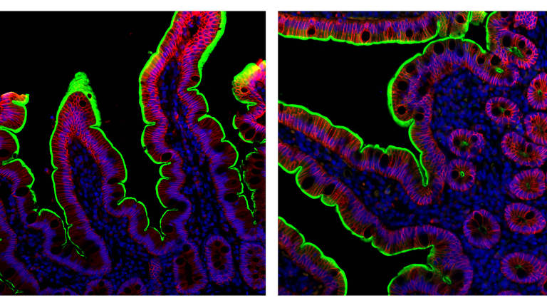 Imagem do ACE2, o receptor para Sars-CoV-2 (o vírus que causa a Covid-19), mostrado em verde, com células epiteliais intestinais em vermelho e núcleos celulares em azul
