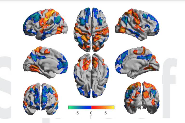 Oito miniaturas coloridas de cérebro em diferentes ângulos
