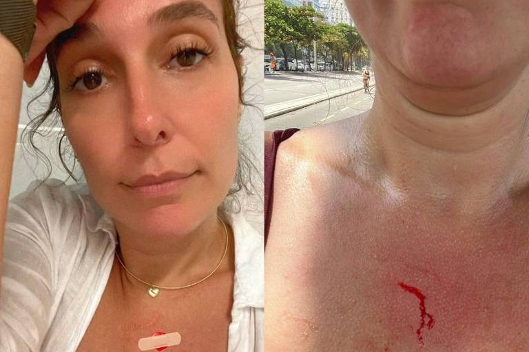 Montagem mostra mulher com machucado próximo à região do pescoço, sangrando