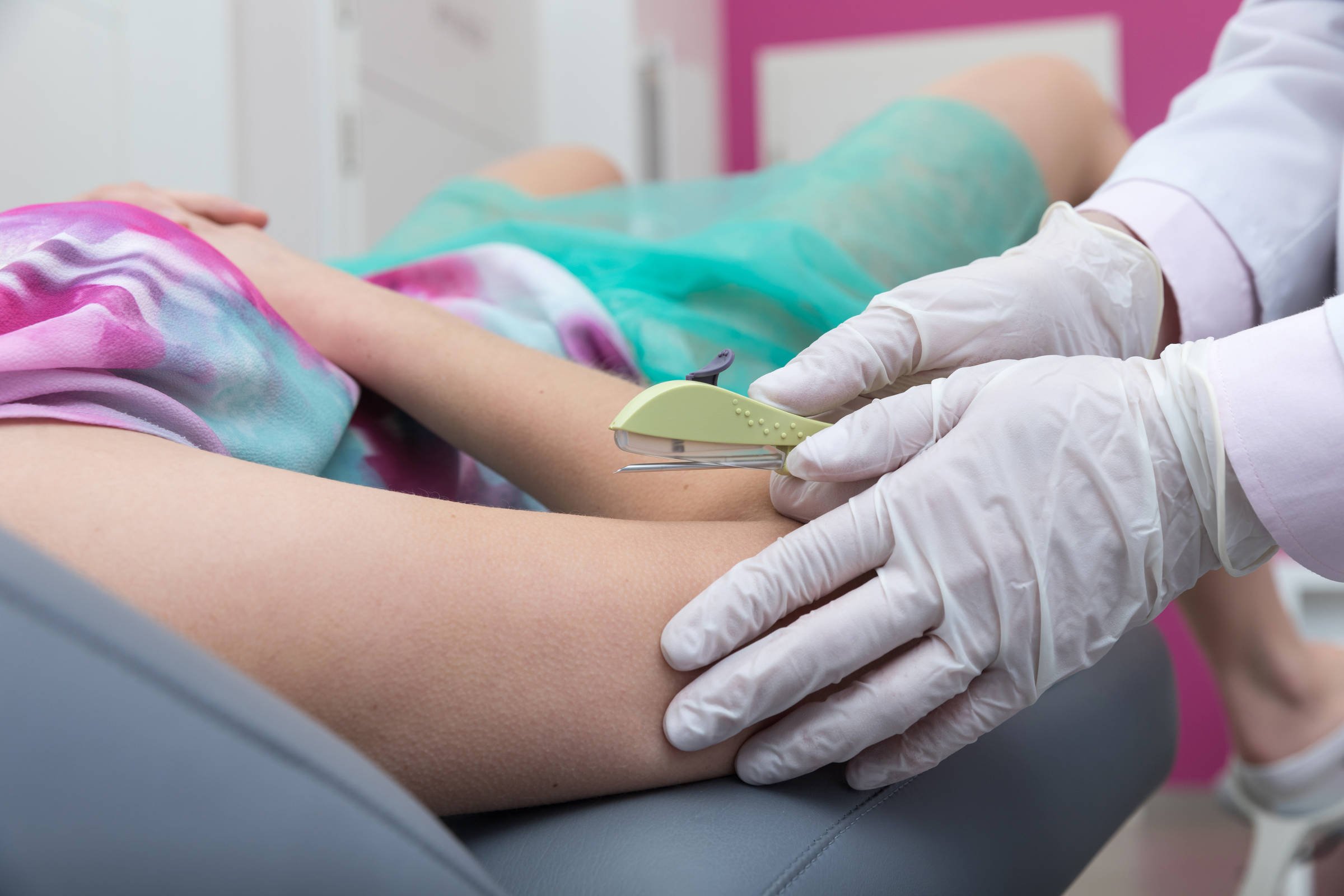 Saiba como funciona o Implanon, método contraceptivo que será oferecido no SUS