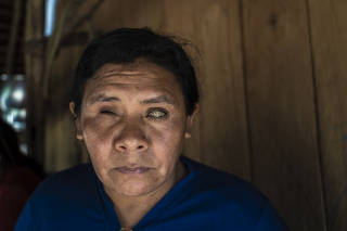 TI Munduruku, Pará, Brasil 2023-03  Retrato de Margarete Karô, 40. Ela reclama de coceiras quando toma banho no igarapé na aldeia Kayru Mayby na Terra Indígena Sai Cinza. Reportagem sobre o povo Munduruku e os efeitos que estão sofrendo com a contami