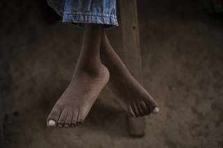 TI Munduruku, Pará, Brasil 2023-03 Pés do menino Moisés Oyoy, 11, que usa cadeira de madeira construida pelo pai porque é deficiente, na aldeia Pombal no Alto Tapajós. Reportagem sobre o povo Munduruku e os efeitos que estão sofrendo com a contamina