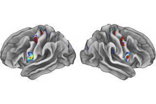 Three colored spots on each half of the brain illuminate special locations in the movement areas of the brain