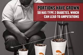 An advertisement to fight obesity created on behalf of the New York City Department of Health