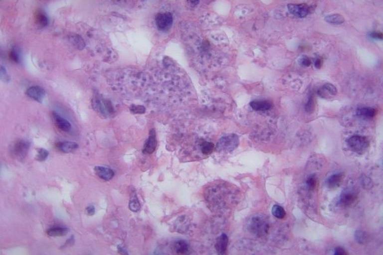 Parasita causador da leishmaniose visto do microscópio