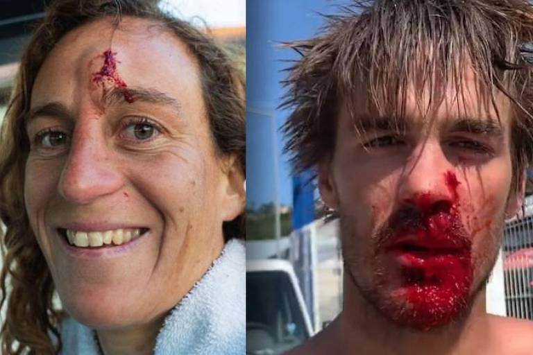 Justine Dupont e Fred David registram frequentemente suas lesões nas redes sociais