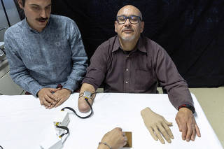 Bionic technology helps amputees feel the temperature of objects again in their phantom hands in Geneva