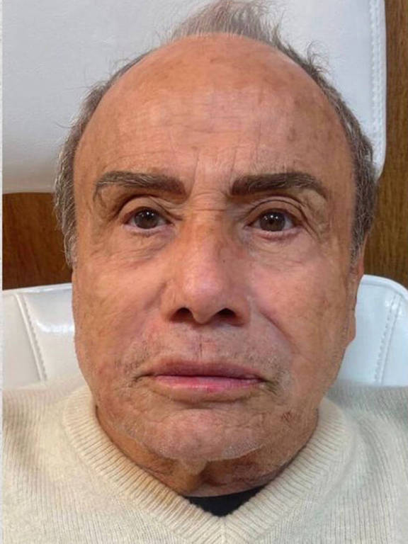 Aos 91 anos, Stenio Garcia exibe resultado de harmonização facial